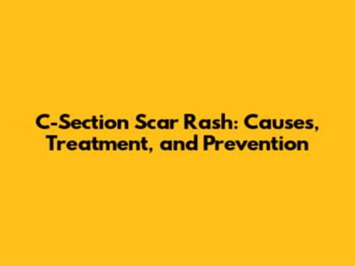 C-Section Scar Rash: Causes, Treatment, and Prevention